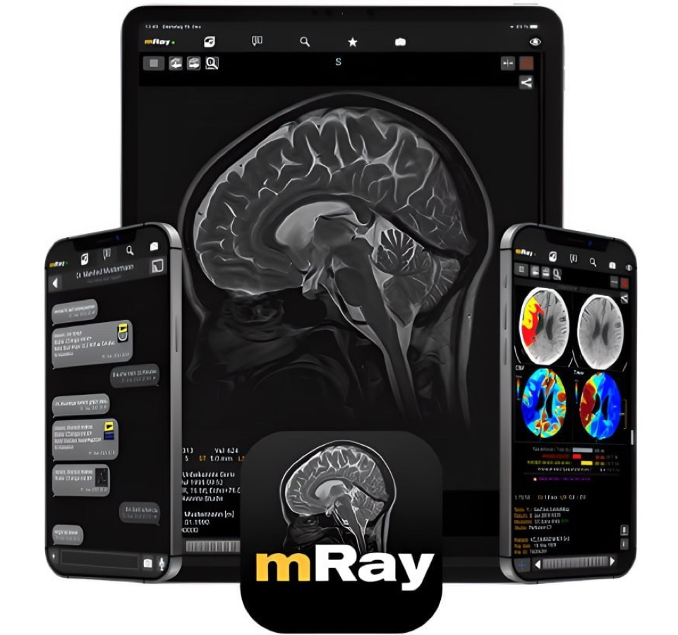 mRay — снимки и заключения на планшетах и телефонах